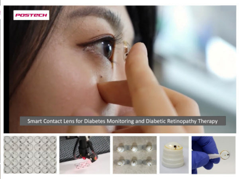 ▲ 포스텍 연구진이 개발한 당뇨 진단 및 치료용 스마트 콘택트렌즈.